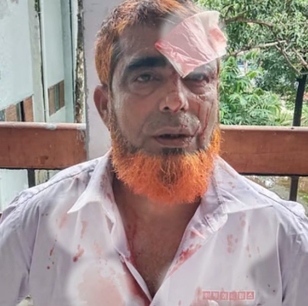 আহত আবদুল মন্নান মৃধা ওরফে চুন্নু