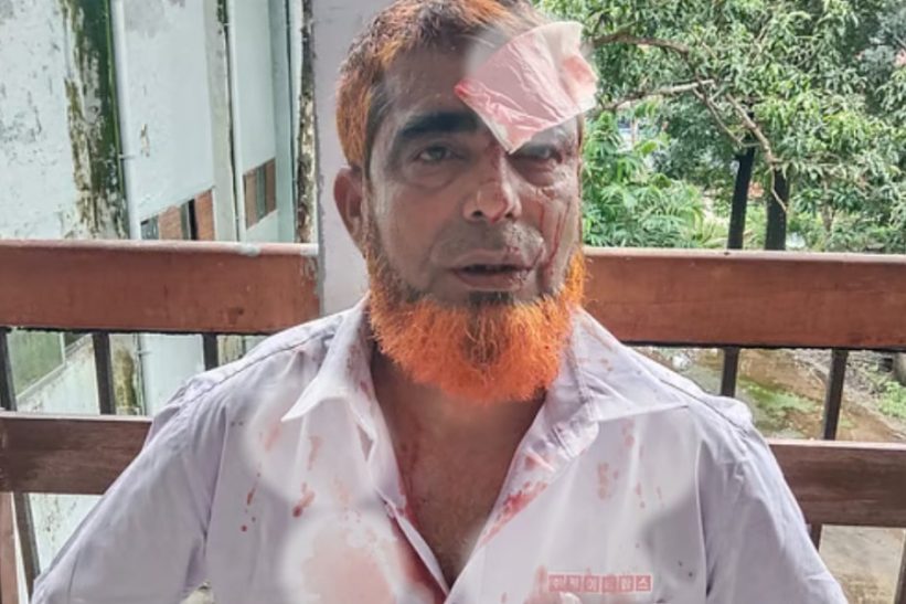 আহত আবদুল মন্নান মৃধা ওরফে চুন্নু